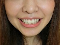 ★歯フェチ写真★26歳歯科衛生士の歯 ★歯フェチ写真★26歳歯科衛生士の歯
